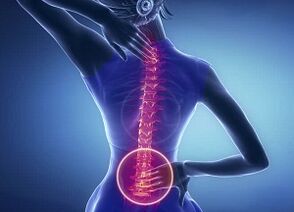 Objawy osteochondrozy lędźwiowej